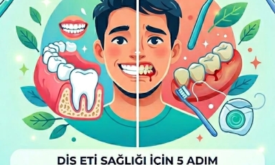 Foto Galeri 4